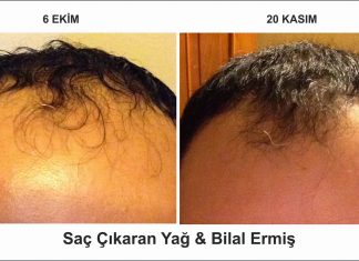 Saç çıkaran yağ ile tanışmak ister misiniz?